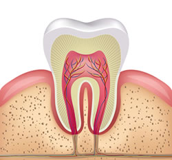 Root Canals in Modesto, CA